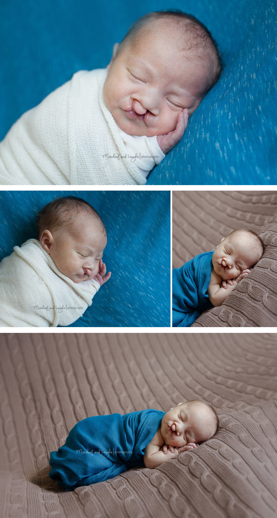 Newborn Baby pictures (baby has a cleft lip, and he's so adorable!) 